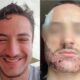 Mathieu Vigier Latour, a 24-year-old student from France, tragically ended his life after an unsuccessful beard transplant...see more